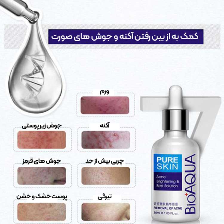 سرم رفع جوش و آکنه بسیار قوی بیوآکوا ( ۳۰ میل )